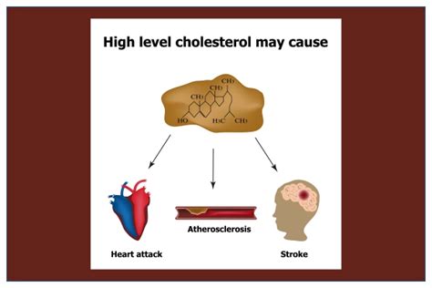 Causes Of High Cholesterol Natural Remedies My Emerald Health