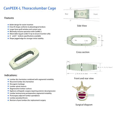 Olif Oblique Lumbar Interbody Fusion Peek Cage System Spine Bone