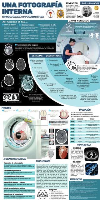 TomografÍa Axial Computarizada Tac Lisset Dayanna Cabra Marcelo Udocz