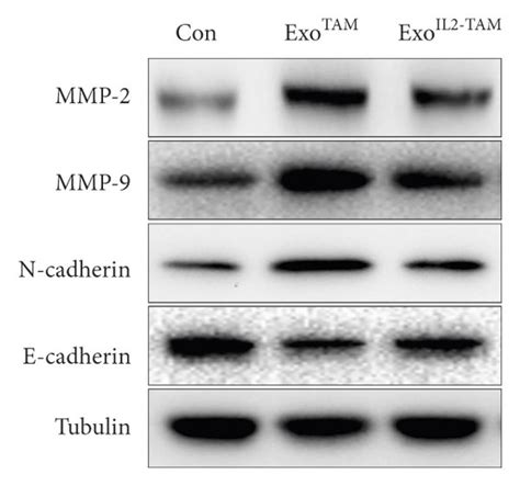 The Effects Of The Exosomes On Hcc Cell Migration In Vitro A