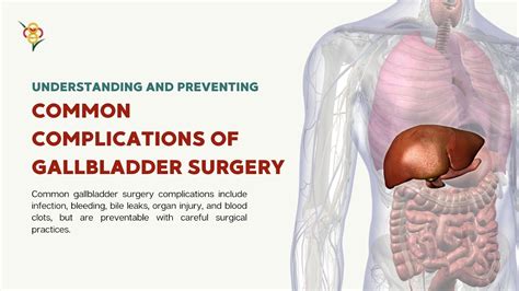 What Are Common Complications of Gallbladder Surgery and How Can They Be Prevented