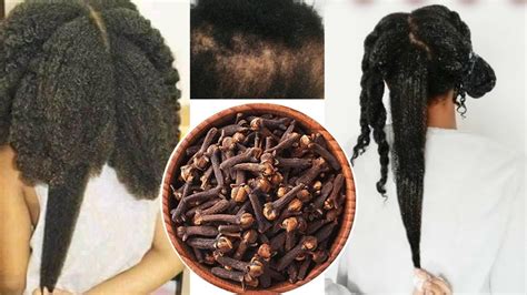 Cloves For Hair Growth Different Ways To Use CLOVES On Your Hair