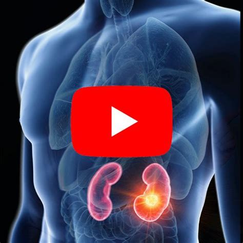 Tumores da Adrenal tratamento e prevenção Dr Rodrigo Freddi