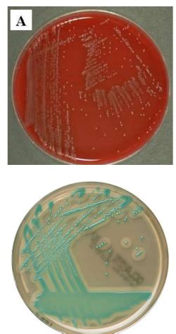 Micro Lecture 21 Listeria Monocytogenes Bacillus Anthracis