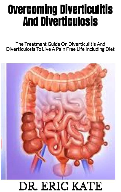 Buy Overcoming Diverticulitis And Diverticulosis: The Guide On ...