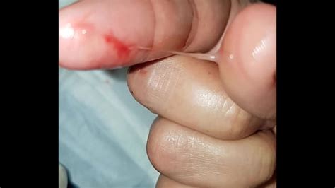 Colombian Amateur Cervix Play Part 9 Xxx Mobile Porno Videos Movies IPornTV Net