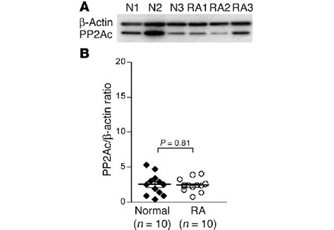 T Cells From Patients With Ra Do Not Express Increased Levels Of Pp2ac