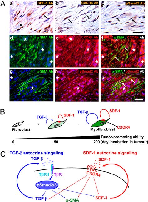 TGF β and SDF 1 autocrine signaling operates in CAFs in invasive human