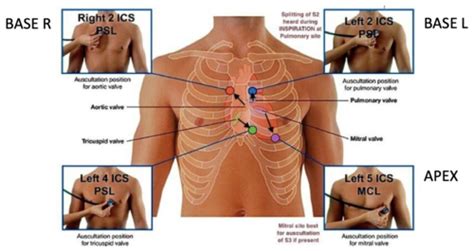 CARDIO 18 Cardiovascular Physical Assessment Flashcards Quizlet