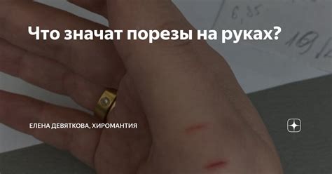 Что значат порезы на руках? | Елена Девяткова, хиромантия | Дзен