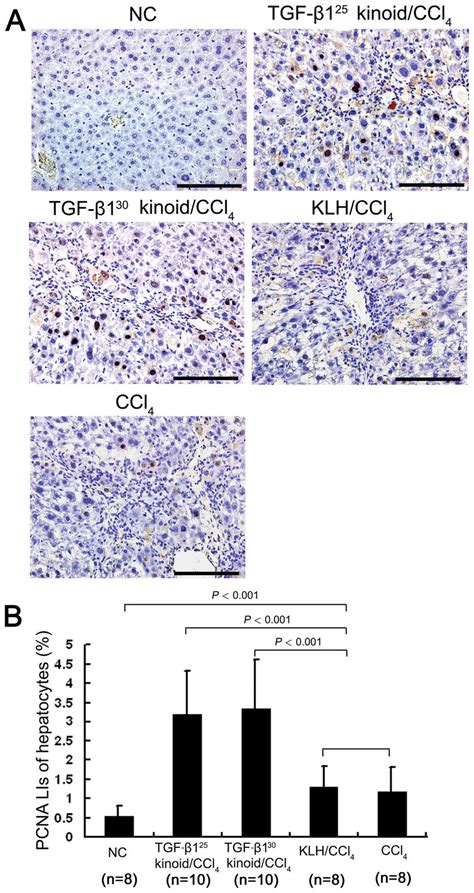 Tgf Vaccination Accelerates Hepatocyte Proliferation In The Fibrotic