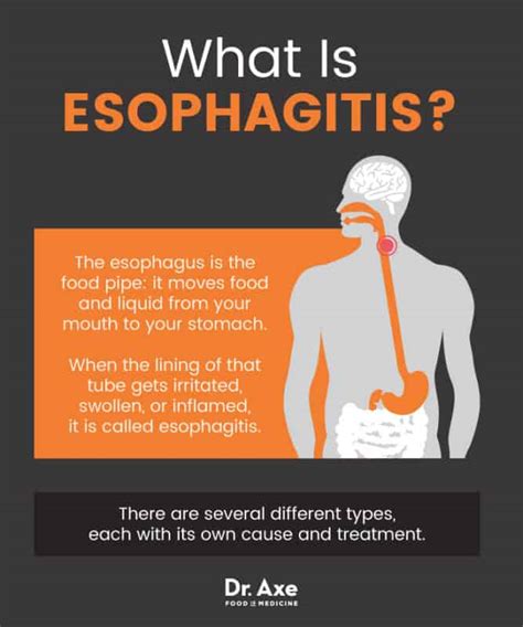 Esophagitis Causes Symptoms Natural Self Care Dr Axe