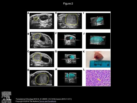 Monitoring Prostate Tumor Growth In An Orthotopic Mouse Model Using