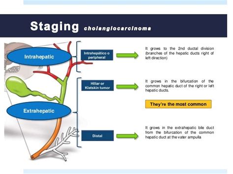 Stages Of Gallbladder Cancer