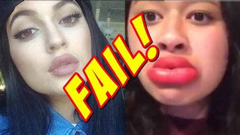 Kylie Jenner Lip Challenge Steps - Famous Person