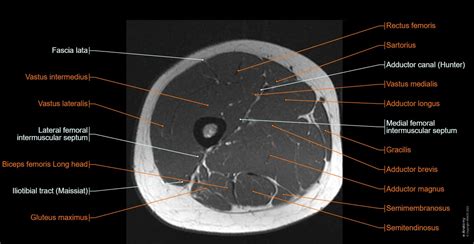 Lower limb: MRI anatomical atlas | e-Anatomy