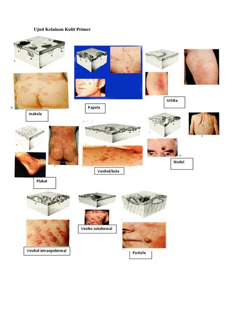 Ujud Kelainan Kulit Primer Sekunder Pdf