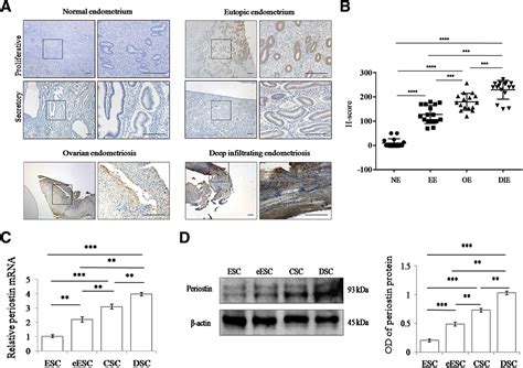 Involvement Of Transcription Factor 21 In The Pathogenesis Of Fibrosis