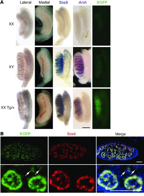 Xx Tg Gonads Have A Normal Male Appearance And Express The Sox3