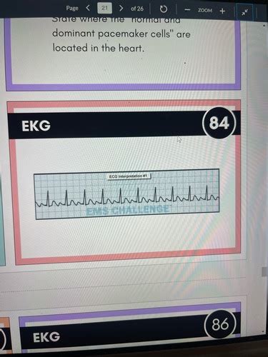 Ekg Flashcards Final Exam Prep Flashcards Quizlet