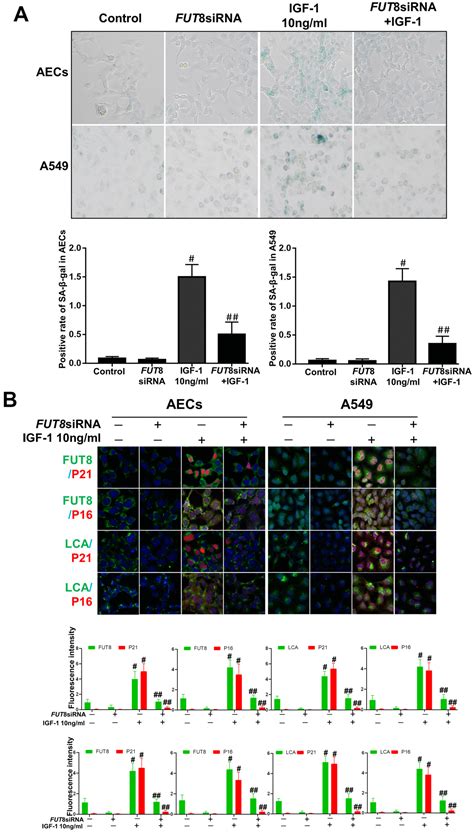 Regulation Of The Igf Signaling Pathway Is Involved In Idiopathic