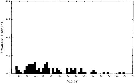 Case 5 DNA Ploidy Histogram Demonstrating Extreme Abnormality With