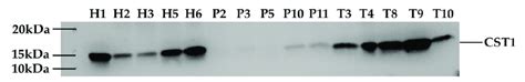 Western blot (WB) analysis of CST1 in salivary samples from 5 healthy... | Download Scientific ...