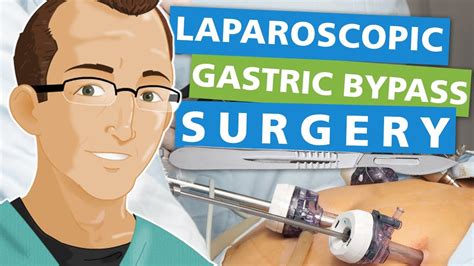 Laparoscopic Gastric Bypass Surgery Youtube