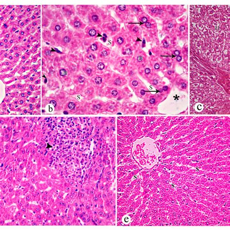 Photomicrographs Of Liver Sections A Control Group Showing