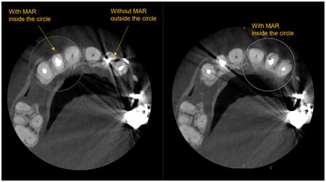 Describe The Purpose And Uses Of Cone Beam Computed Tomography