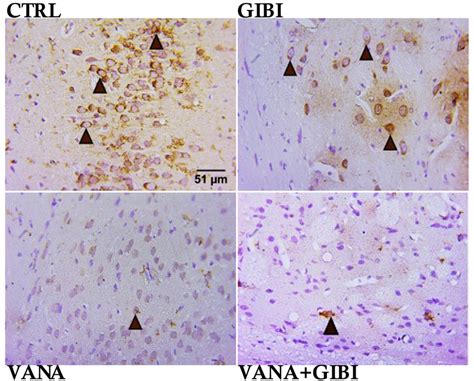 Immunohistochemical Photomicrograph Showing The Neuronal Cell