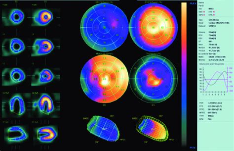 Representative Display For Cedars Sinai Medical Center S QGS Software