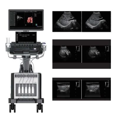 Trolley Type Ultrasonic D D Color Dopple Windows Embedded Color