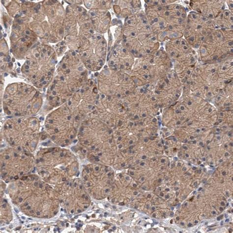 Anti Nbea Antibody Produced In Rabbit