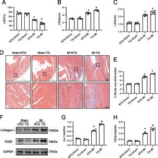 Effect Of Usp Cardiac Specific Overexpression On Atrial Fibrosis