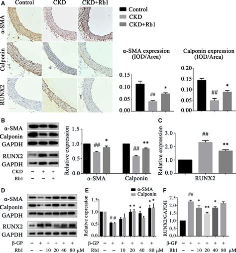 Rb Inhibits Vsmc Phenotype Switching In Vivo And In Vitro A