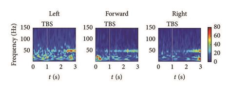 LFP spectral properties during the goal-directed task. (a) Illustration ... 