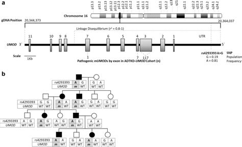 Genetic And Clinical Predictors Of Age Of ESKD In Individuals With