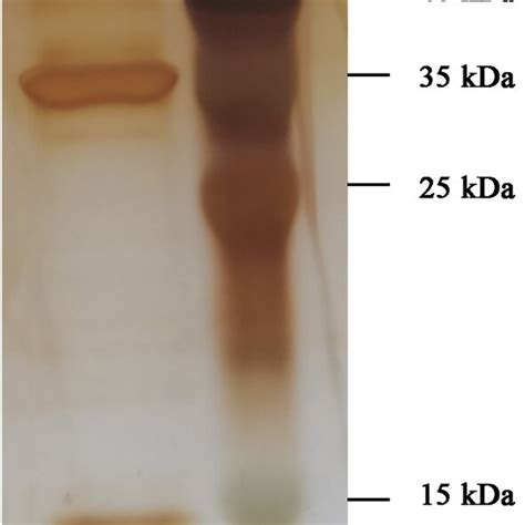 SDS PAGE Of The Purified Structural Proteins Of Phage STP55 Particle 1