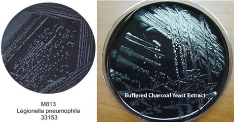 Bcye Agar Composition Principle Preparation Results Uses