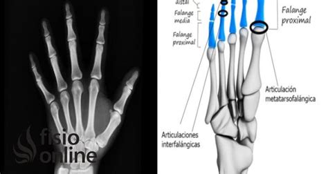 Descubre Los Secretos De Los Huesos Falanges