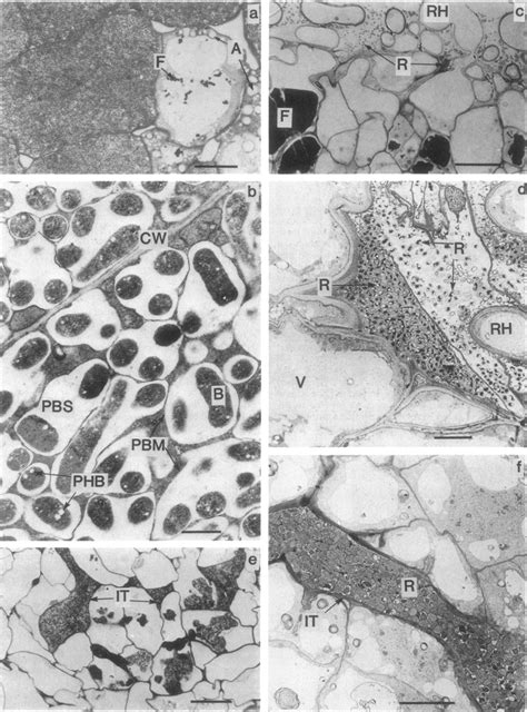 Micrographs Of 30 Day Old Nodules And Tumor Like Structures Formed On