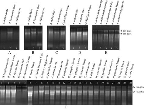 Denaturing Agarose Gel Electrophoresis Of Total Rna Isolated From A Download Scientific