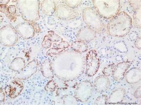 Anti-N-Cadherin Antibody | SDIX, LLC