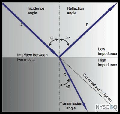 Ultrasound Physics - NYSORA The New York School of Regional Anesthesia