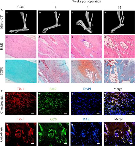 Heterotopic Cartilage And Bone In Heterotopic Ossification Ho Are Download Scientific Diagram