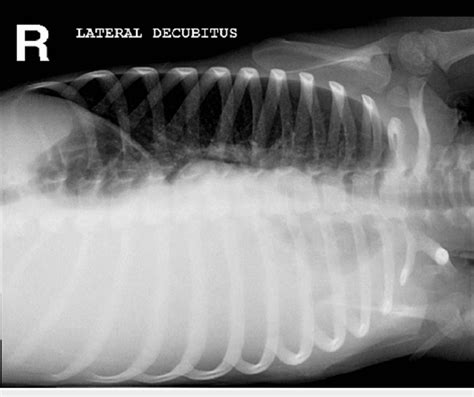 Chest Radiography Showing Minimal Left Sided Pleural - vrogue.co
