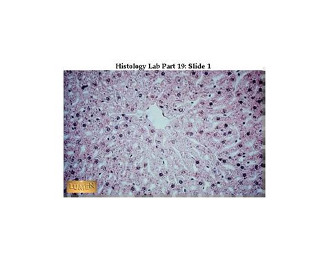 Liver Lobule histology Quiz