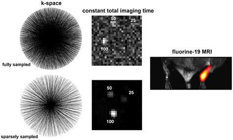 Enhanced Detection Of Paramagnetic Fluorine‐19 Magnetic Resonance