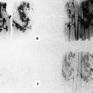 Autoradiograph Of Paired Sections From Cardiac Tissue Sampled Days